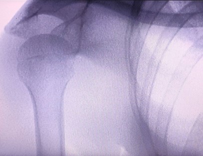 Complete display of shoulder details Complete display of shoulder details