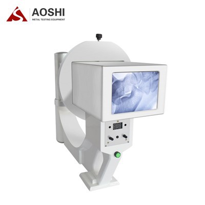 Röntgen av extremiteter